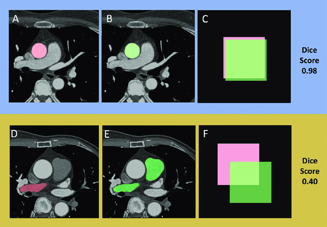 AI Training Benchmark Graphic